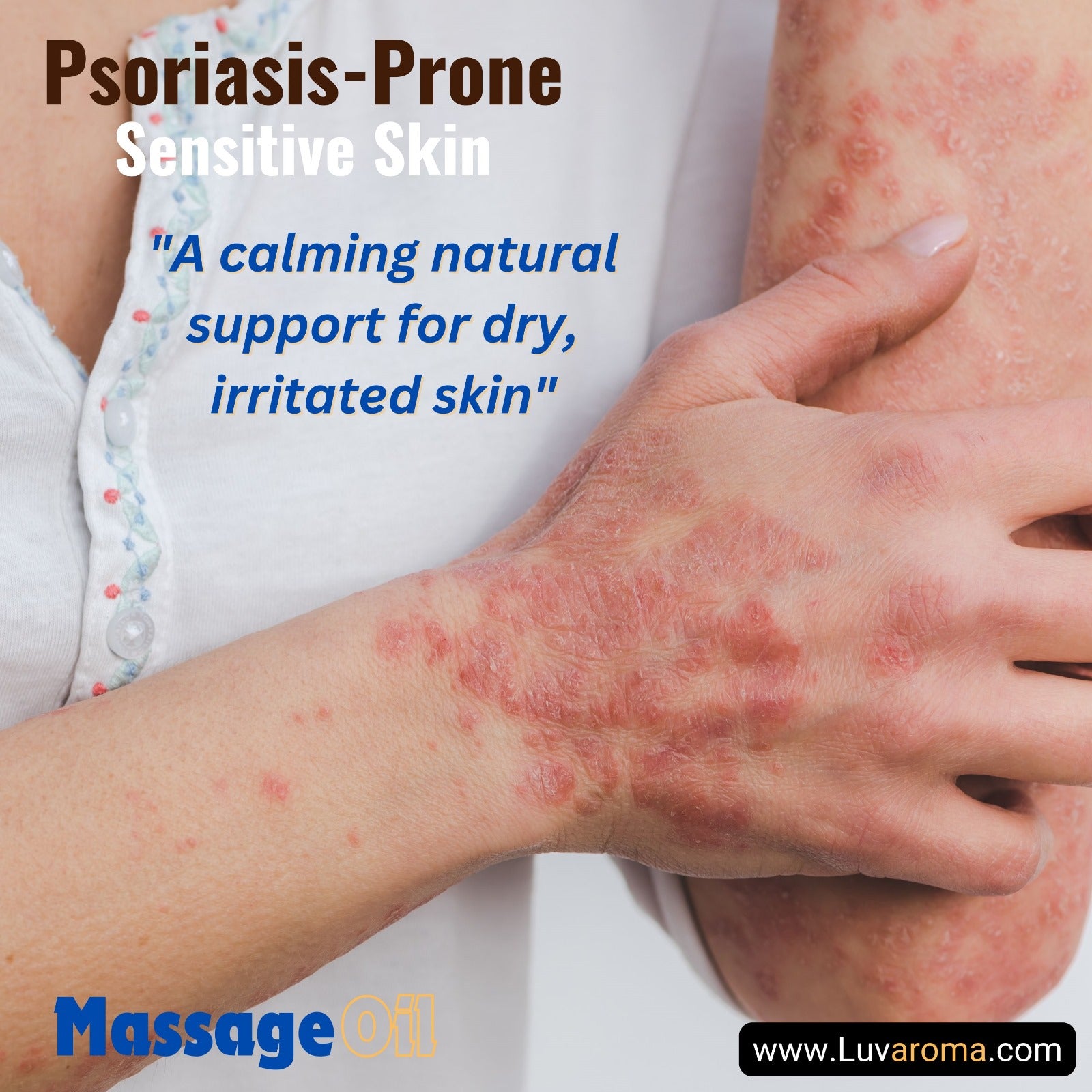 Psoriasis Relief